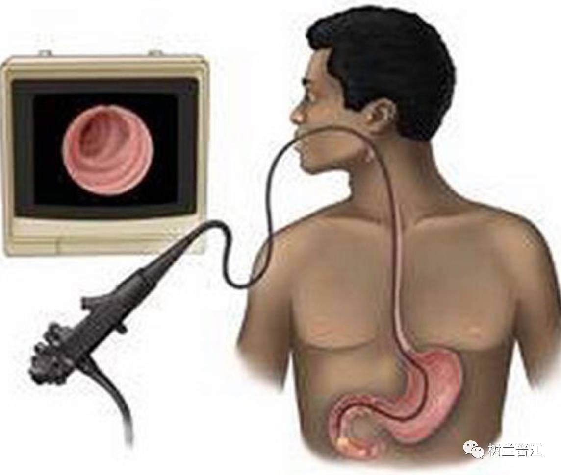 最新肠胃镜技术，消化健康的新里程碑