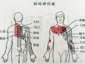 最新中医针灸，古老疗法现代应用与发展探索